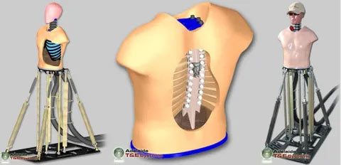 Thoracic Surrogate